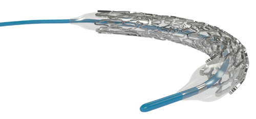 STENT PERIFÉRICO